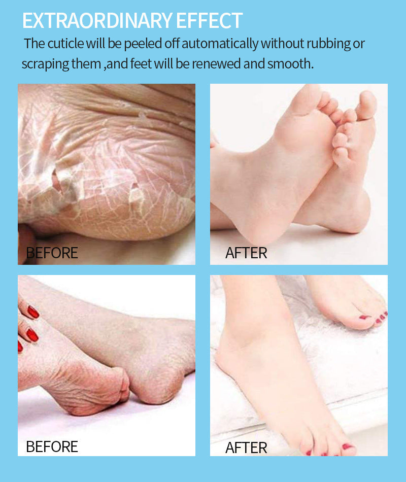 Lavender Olive Foot Mask Calluses Dead Skin Horny Foot Mask Foot Cover Lavender Olive Foot Mask Calluses Dead Skin Horny Foot Mask Foot Cover