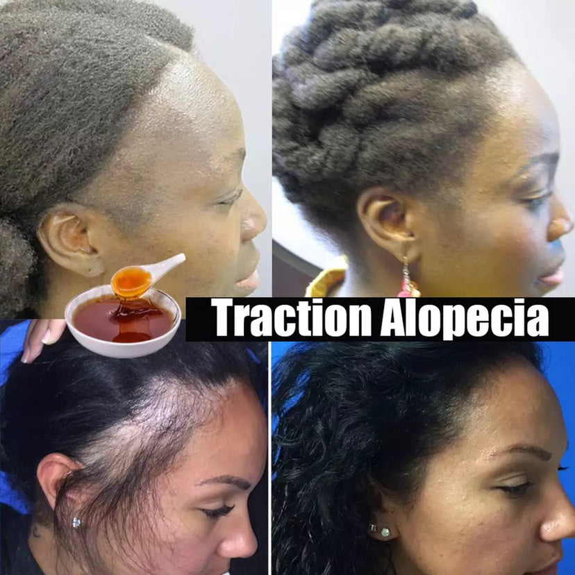 African Natural Herbal Hair Growth Chebe Powder Shampoo