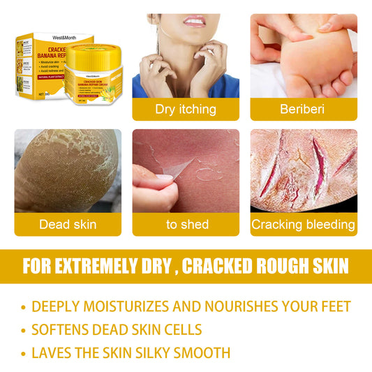 Banana Foot Repair Cream Chapped Moisturizing Care